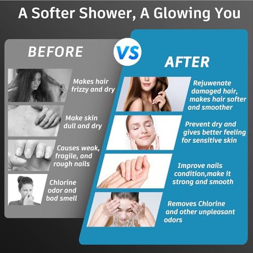 FEELSO Filtered Shower Head, High Pressure Shower Head with Filters - Image 7