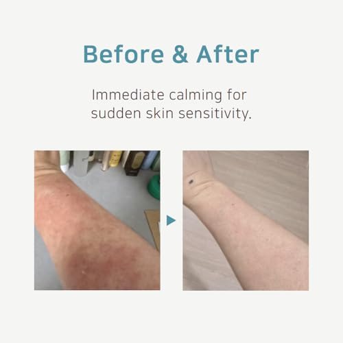 Ato Cream, Intense Soothing Relief for Dry & Itchy Sensitive Skin, 160ml - Daily Face & Body Moisturizer with Green Tea Water & 15 Herbs, Fragrance-Free Skin Barrier Recovery - Image 5