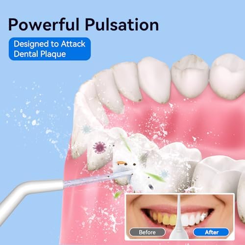 Cordless Portable Water Flosser with 300ML Tank: Rechargeable Oral Irrigator with 5 Tips for Travel, Braces Care and Sensitive Gums, IPX7 Waterproof Teeth Cleaning Device(Blue - Image 2