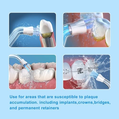 4pcs Replacement Dental Plaque Seeker Tips for Waterpik Water Flosser and Other Brand Oral Irrigator, Replacement Heads for Waterpik - Image 5