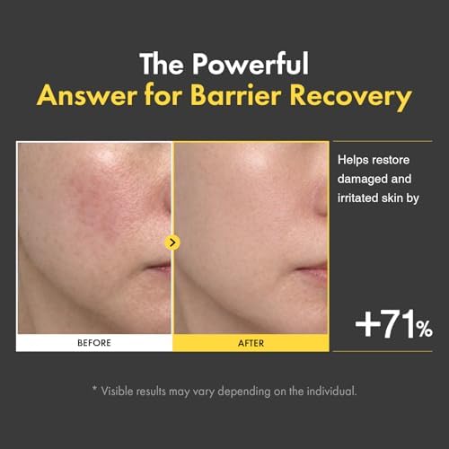 TOSOWOONG Ceramide Barrier Cream for Dry & Sensitive Skin, Hydrating, Dewy - Image 2