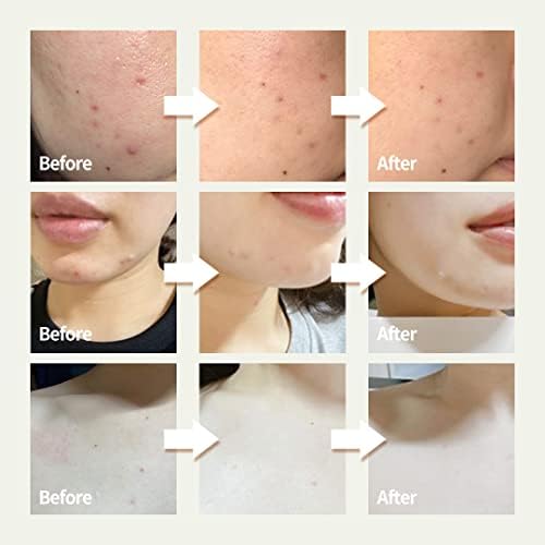 OxygenCeuticals Skin Barrier Ato Cream – Protective Cream with Fucoidan V, Shea Butter & Centella Asiatica, Strengthen Skin Barrier & Soothe Sensitive Skin. 0.67 fl.oz (20ml) - Image 2