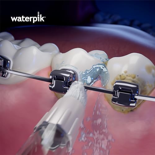 Waterpik Water Flosser Orthodontic Replacement Tips, 2 Count OD-100E - Image 4