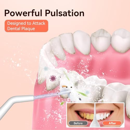 Cordless Portable Water Flosser with 300ML Tank: Rechargeable Oral Irrigator with 5 Tips for Travel, Braces Care and Sensitive Gums, IPX7 Waterproof Teeth Cleaning Device(Pink) - Image 3