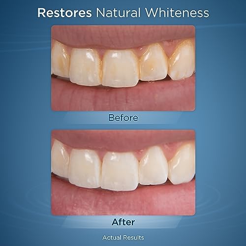 Waterpik Fresh Mint Whitening Refill Tablets (30 Count), Restore Natural Teeth Whiteness, Packaging May Vary, WT-30 - Image 5