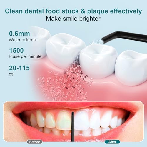 Nicefeel Water Dental Flosser Teeth Pick - Fast Charge Cordless Teeth Cleaner, 3 Modes Portable Oral Irrigator, IPX7 Waterproof Electric Water Dental Flosser for Tonsil Stone, 300ML Tank - Image 2