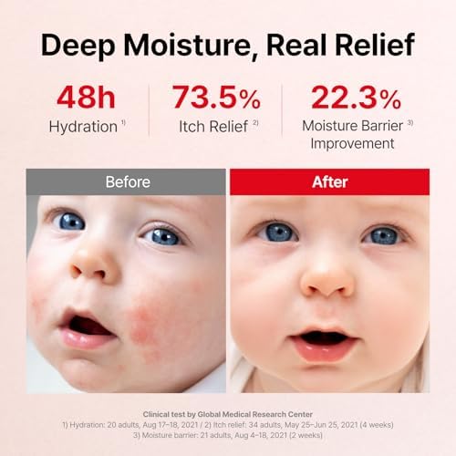 ATOPALM MLE Eczema Cream and Soothing Gel Lotion Bundle - Image 4