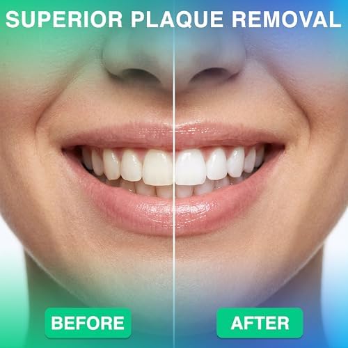 Professional Water Flosser - Advanced Dental Care for a Healthier Mouth, Gum, and Teeth - IPX7 Waterproof Oral Irrigator | 6 Replacement Tips, Travel-Friendly, Rechargeable - Oral Hygiene (Grey) - Image 6