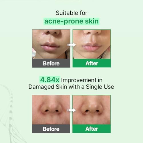 Zipiderm EGF Skin Barrier Deep Moisture Set - Image 5