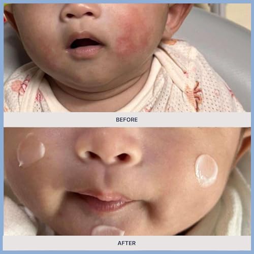 Mongdies Baby Ato Balm | Intensive Moisture Barrier Balm for Dry Sensitive Skin | Non Sticky Ceramide Balm with Plant Oils | For Cheeks Hands & Dry Areas | Vegan EWG Green | 1.05 oz | 2 Pack - Image 6