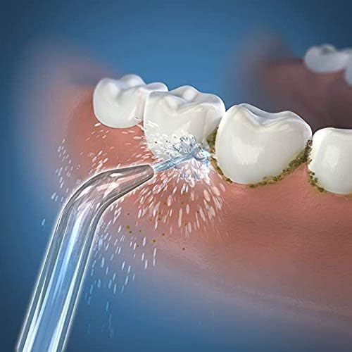 Dental Water Classic Jet Tips Compatible with Waterpik Water Flosser - Image 2
