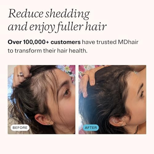 MDhair Mounted & Handheld Filtered Shower Head Bundle for Hard Water - Image 6