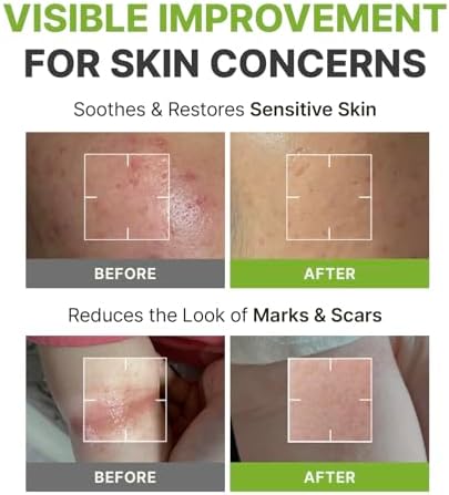 Rbfy. Daily Ampoule Toner Pads (100 Pads) with Centella Asiatica - Image 3