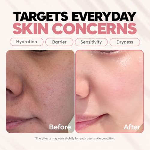 Ceramide, Ectoin & Hyaluronic Acid Lotion for Dry & Sensitive Skin, Barrier Repair Moisturizer, Fragrance-Free, Dermatologically Tested, Korean Skincare, 100 ml - Image 5