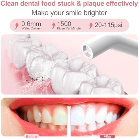 Nicefeel Water Flosser, 300ML Portable Water Dental Pick Cordless for Teeth, Braces, Sensitive Gum, Oral Irrigator for Travel & Home with 5 Jet Tips & 3 Modes, Rechargeable, IPX7 Waterproof - Image 2
