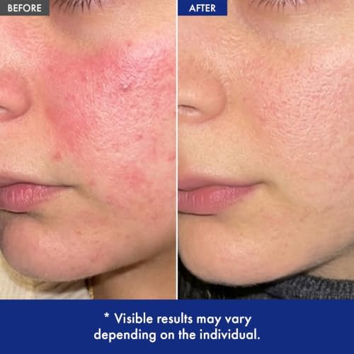365 Barrier Cream, 5% Panthenol & Ceramide for Sensitive Dry Skin - Image 4