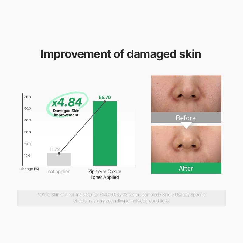 Zipiderm EGF Skin Barrier Repair Set - Cream Toner+Ampoule+Cream - Image 3