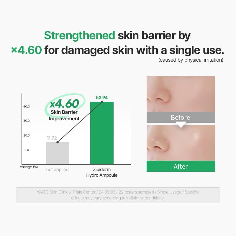 Zipiderm EGF Skin Barrier Repair Set - Cream Toner+Ampoule+Cream - Image 5
