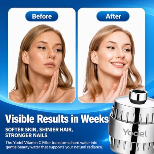 Yodel KDF-55 Shower Filter for Hard Water with Vitamin C,Activated Carbon - Image 4