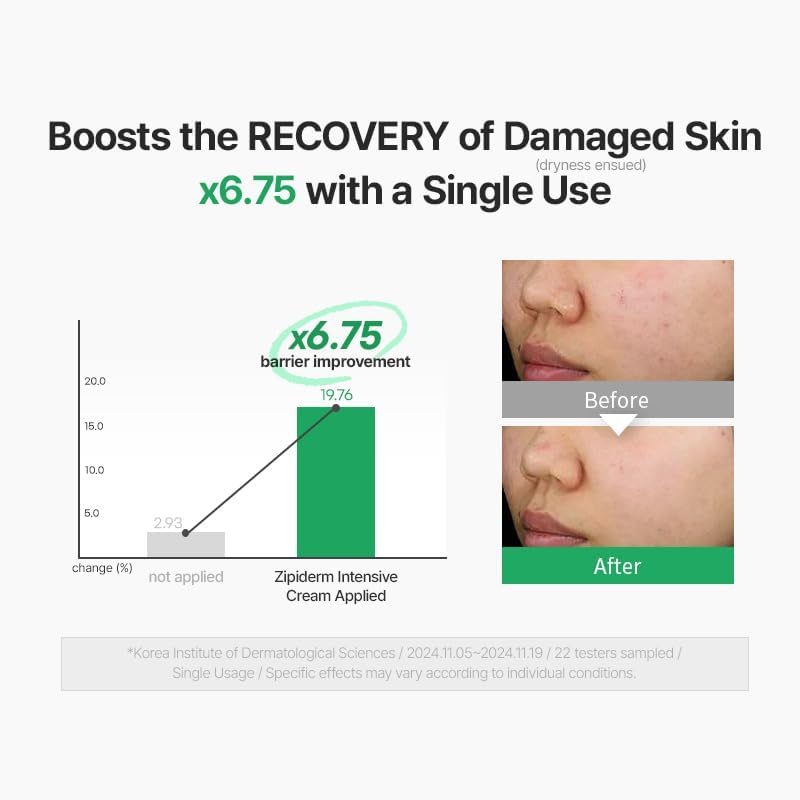 Zipiderm EGF Skin Barrier Repair Set - Cream Toner+Ampoule+Cream - Image 7