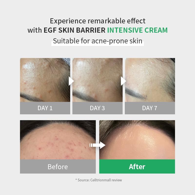 Zipiderm EGF Skin Barrier Repair Set - Cream Toner+Ampoule+Cream - Image 6