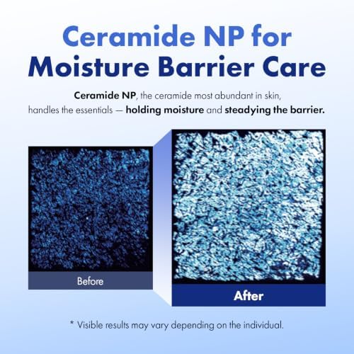 365 Barrier Cream, 5% Panthenol & Ceramide for Sensitive Dry Skin - Image 6
