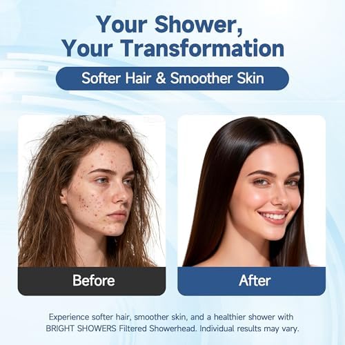 BRIGHT SHOWERS Filtered Shower Head with Handheld, High Pressure 9 Spray Mode Showerhead with Long Hose and Bracket, Water Softener Filters Beads for Hard Water - Removes Chlorine, Matte Black - Image 4