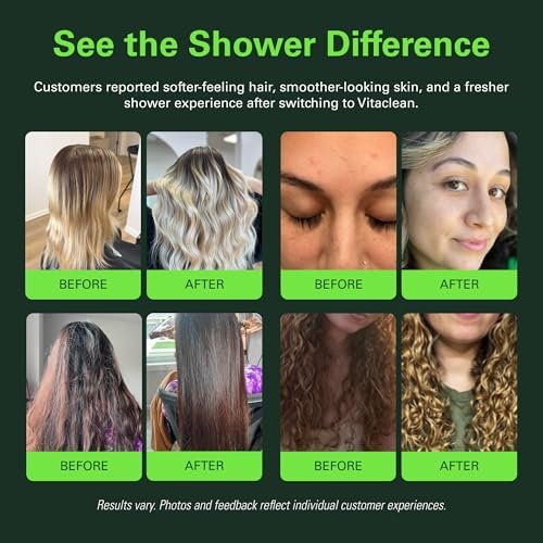Ultra Vitamin C Shower Head Filter Wall Mount, Space Grey | High Pressure, Filters Hard Water, Chlorine, Rust & Odor, Aromatherapy Vitamin C and E, Skin & Hair Health - Image 5