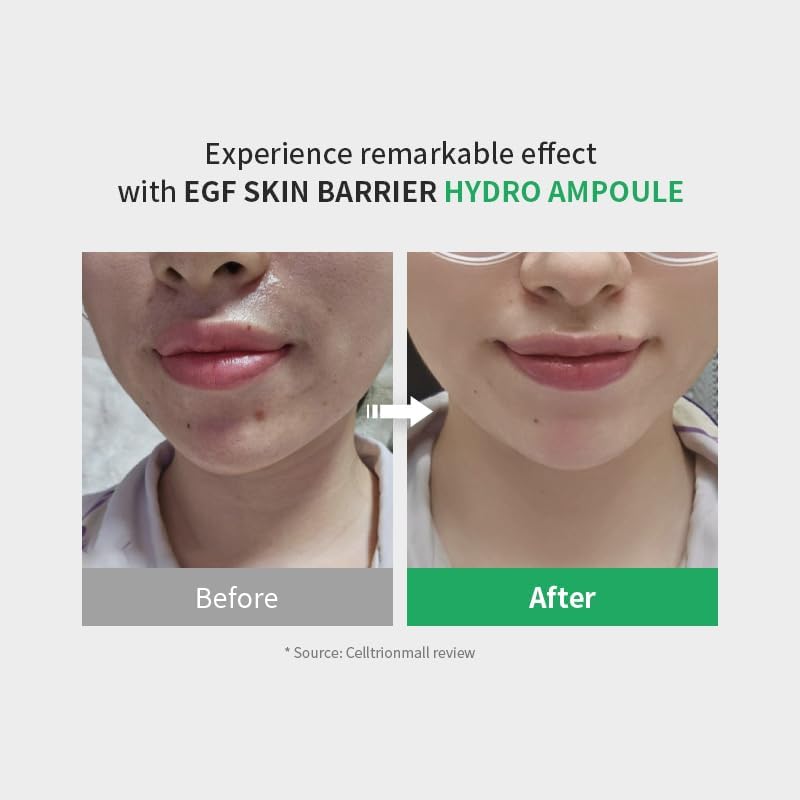 Zipiderm EGF Skin Barrier Repair Set - Cream Toner+Ampoule+Cream - Image 4